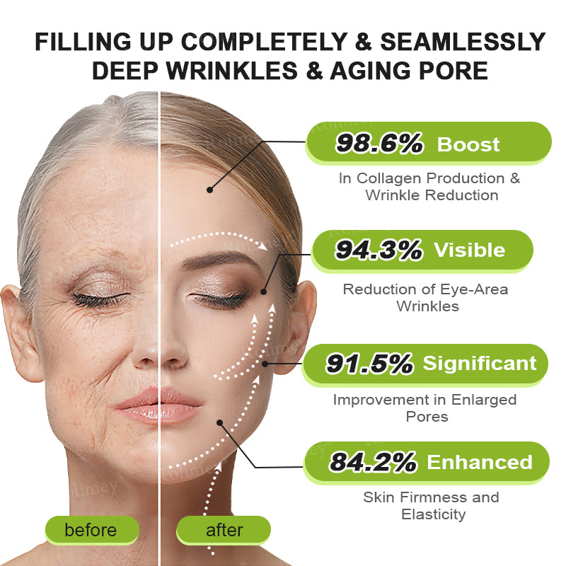 👨‍⚕️💙Made and shipped from Australia 💫Rolimey® Botox & Vita-A Retinol Shot Wrinkle-Lift Tightening cream - Last Day Promotion 70% OFF