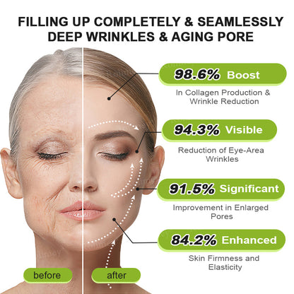 👨‍⚕️💙Made and shipped from Australia 💫Rolimey® Botox & Vita-A Retinol Shot Wrinkle-Lift Tightening cream - Last Day Promotion 70% OFF