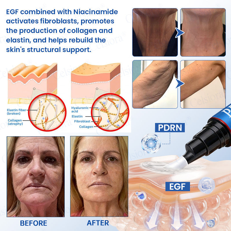 💙🥽Made and shipped from Australia💫Celsiora® Botox & PDRN Anti-Wrinkle Shot – Lift & Firming Cream- Last Day Promotion 70% OFF