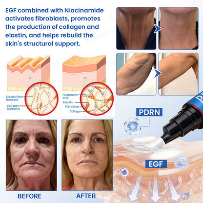 💙🥽Made and shipped from Australia💫Celsiora® Botox & PDRN Anti-Wrinkle Shot – Lift & Firming Cream- Last Day Promotion 70% OFF