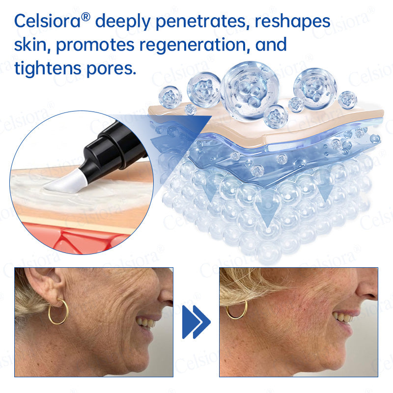 💙🥽Made and shipped from Australia💫Celsiora® Botox & PDRN Anti-Wrinkle Shot – Lift & Firming Cream- Last Day Promotion 70% OFF