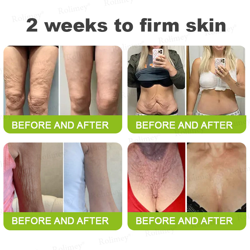 👨‍⚕️💙Made and shipped from Australia 💫Rolimey® Botox & Vita-A Retinol Shot Wrinkle-Lift Tightening cream - Last Day Promotion 70% OFF
