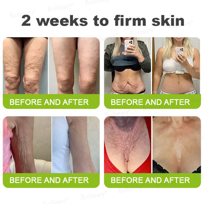 👨‍⚕️💙Made and shipped from Australia 💫Rolimey® Botox & Vita-A Retinol Shot Wrinkle-Lift Tightening cream - Last Day Promotion 70% OFF
