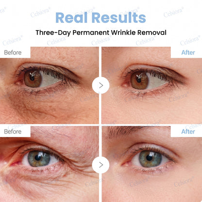 💙🥽Made and shipped from Australia💫Celsiora® Botox & PDRN Anti-Wrinkle Shot – Lift & Firming Cream- Last Day Promotion 70% OFF