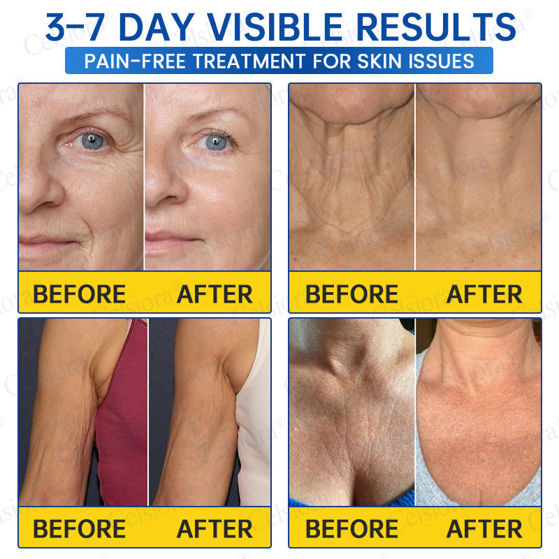 💙🥽Made and shipped from Australia💫Celsiora® Botox & PDRN Anti-Wrinkle Shot – Lift & Firming Cream- Last Day Promotion 70% OFF