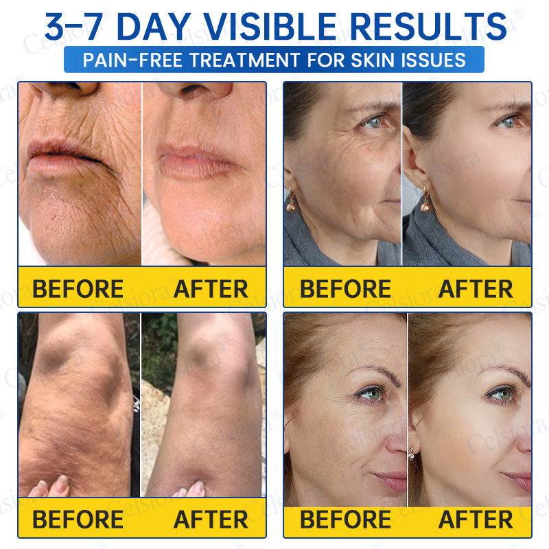 💙🥽Made and shipped from Australia💫Celsiora® Botox & PDRN Anti-Wrinkle Shot – Lift & Firming Cream- Last Day Promotion 70% OFF