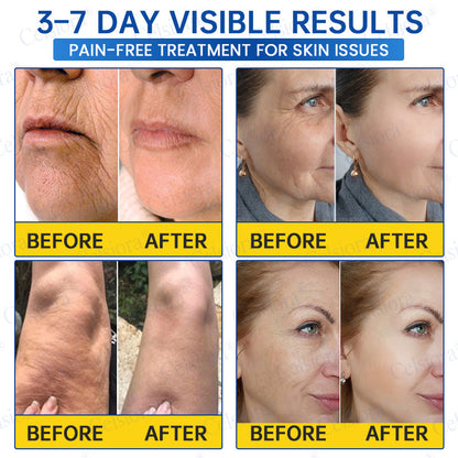 💙🥽Made and shipped from Australia💫Celsiora® Botox & PDRN Anti-Wrinkle Shot – Lift & Firming Cream- Last Day Promotion 70% OFF