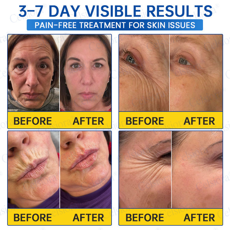 💙🥽Made and shipped from Australia💫Celsiora® Botox & PDRN Anti-Wrinkle Shot – Lift & Firming Cream- Last Day Promotion 70% OFF