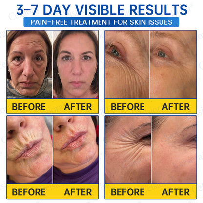 💙🥽Made and shipped from Australia💫Celsiora® Botox & PDRN Anti-Wrinkle Shot – Lift & Firming Cream- Last Day Promotion 70% OFF